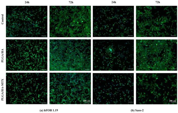 https://cdn.ncbi.nlm.nih.gov/pmc/blobs/f559/11207774/1291d81579e5/pharmaceutics-16-00754-g008.jpg