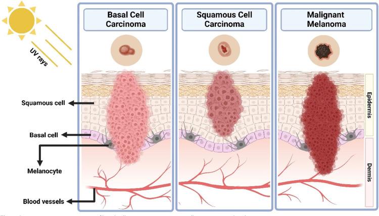 https://cdn.ncbi.nlm.nih.gov/pmc/blobs/f559/11929540/12ba6a63e7f1/IJN-20-3527-g0001.jpg