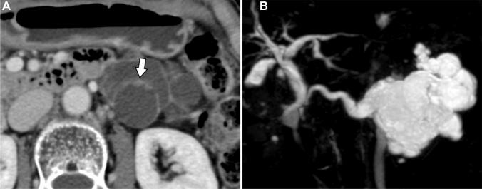 https://cdn.ncbi.nlm.nih.gov/pmc/blobs/f55d/10333142/d638d7b6bee6/261_2023_3985_Fig4_HTML.jpg