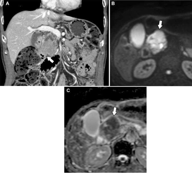 https://cdn.ncbi.nlm.nih.gov/pmc/blobs/f55d/10333142/f6be6181cd45/261_2023_3985_Fig5_HTML.jpg
