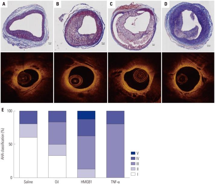 https://cdn.ncbi.nlm.nih.gov/pmc/blobs/f560/4960374/15f7914146a2/ymj-57-1095-g006.jpg