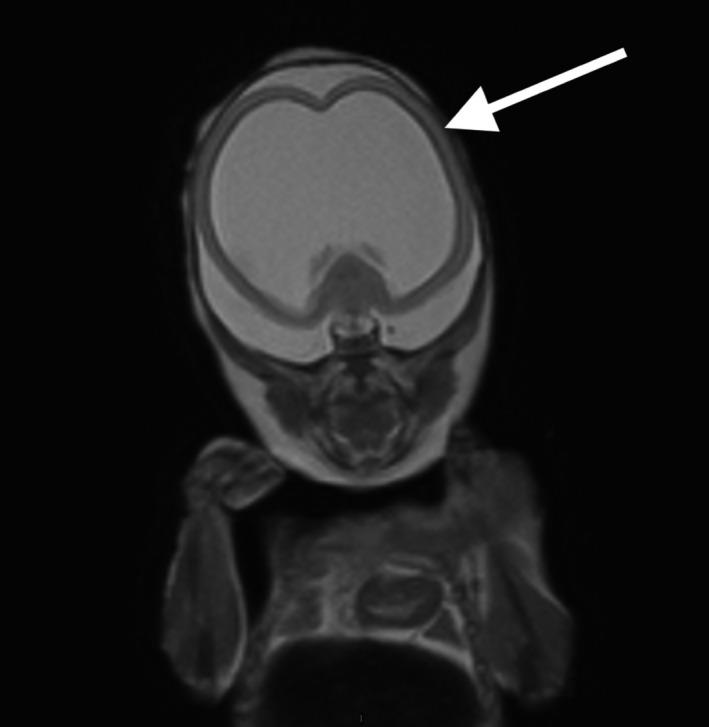 https://cdn.ncbi.nlm.nih.gov/pmc/blobs/f561/6618902/59482950657b/AOGS-98-865-g003.jpg