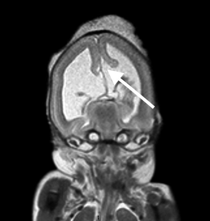 https://cdn.ncbi.nlm.nih.gov/pmc/blobs/f561/6618902/9eb3ffc31d95/AOGS-98-865-g004.jpg