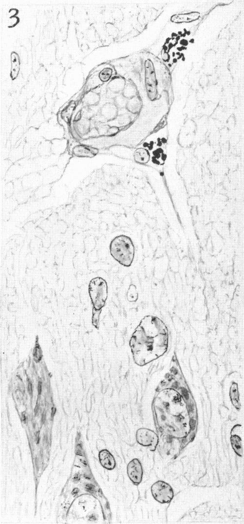 https://cdn.ncbi.nlm.nih.gov/pmc/blobs/f565/1249100/5e31e2804743/janat00539-0033-c.jpg
