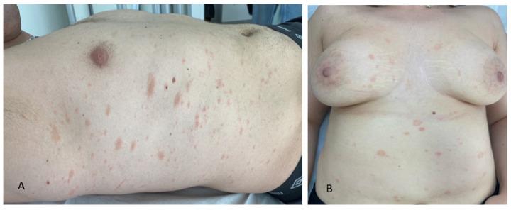 https://cdn.ncbi.nlm.nih.gov/pmc/blobs/f572/11595004/68a8bd922172/jcm-13-06666-g001.jpg