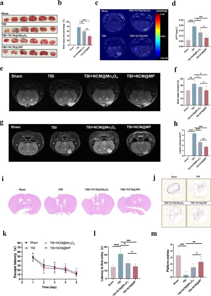 https://cdn.ncbi.nlm.nih.gov/pmc/blobs/f573/11320991/e774a28b465b/12951_2024_2753_Fig4_HTML.jpg