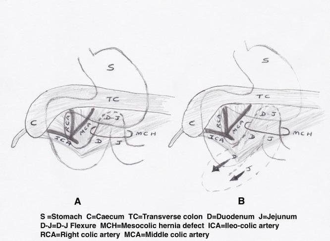 https://cdn.ncbi.nlm.nih.gov/pmc/blobs/f577/5117281/18d99d6b2401/jns-5-58.f3.jpg
