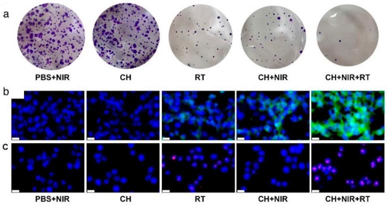 https://cdn.ncbi.nlm.nih.gov/pmc/blobs/f578/12293111/be6f5287b9b2/cancers-17-02295-g005.jpg