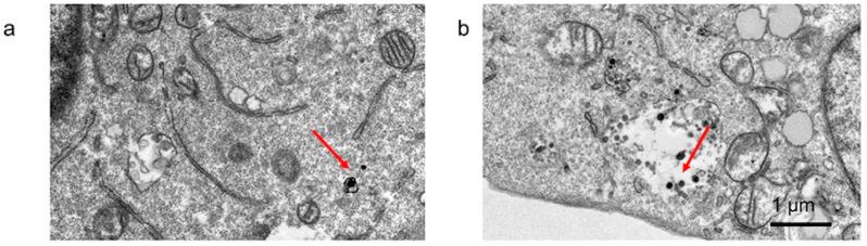 https://cdn.ncbi.nlm.nih.gov/pmc/blobs/f578/12293111/da7d2d6fe86b/cancers-17-02295-g004.jpg