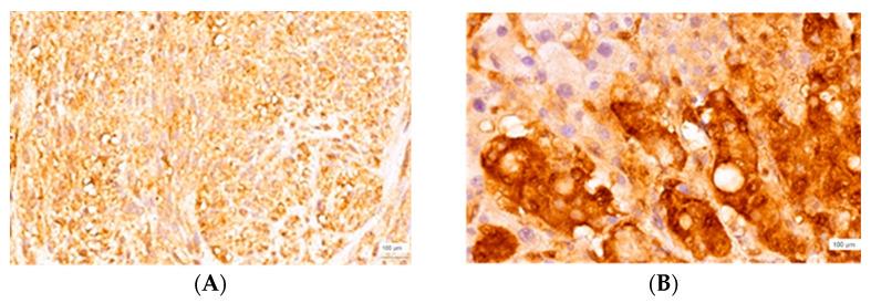 https://cdn.ncbi.nlm.nih.gov/pmc/blobs/f57c/9956008/a80961dd1109/cimb-45-00091-g005.jpg