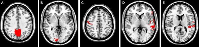 https://cdn.ncbi.nlm.nih.gov/pmc/blobs/f582/3607808/47de844b1b48/fnhum-07-00095-g0001.jpg