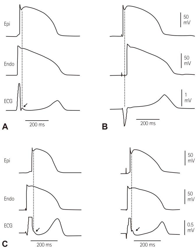 https://cdn.ncbi.nlm.nih.gov/pmc/blobs/f583/5054169/2f4945ac628b/kcj-46-601-g001.jpg