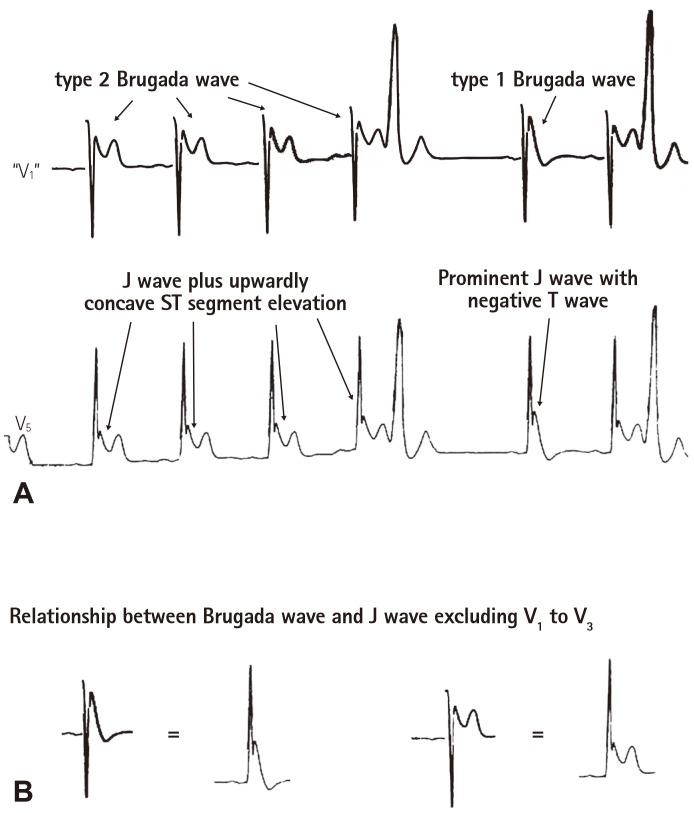 https://cdn.ncbi.nlm.nih.gov/pmc/blobs/f583/5054169/35145fe0c4a2/kcj-46-601-g006.jpg