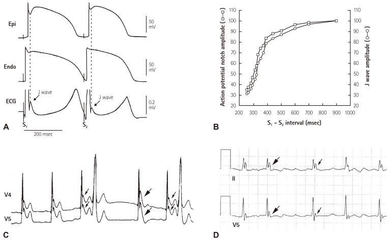 https://cdn.ncbi.nlm.nih.gov/pmc/blobs/f583/5054169/47ebfb02f8b5/kcj-46-601-g004.jpg