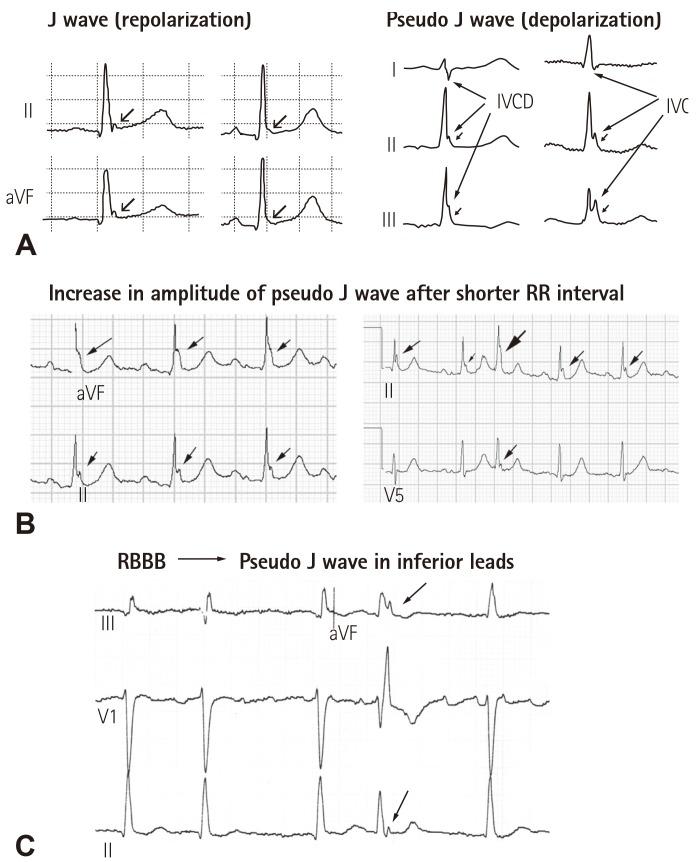 https://cdn.ncbi.nlm.nih.gov/pmc/blobs/f583/5054169/ef30197d95bc/kcj-46-601-g002.jpg