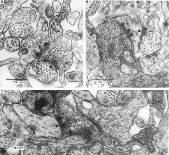 https://cdn.ncbi.nlm.nih.gov/pmc/blobs/f588/1165089/403293501298/janat00196-0108-b.jpg