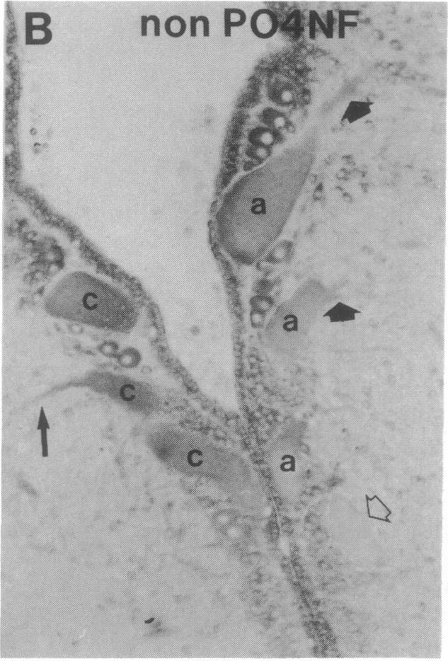https://cdn.ncbi.nlm.nih.gov/pmc/blobs/f588/51798/f3b27f87f998/pnas01061-0464-b.jpg