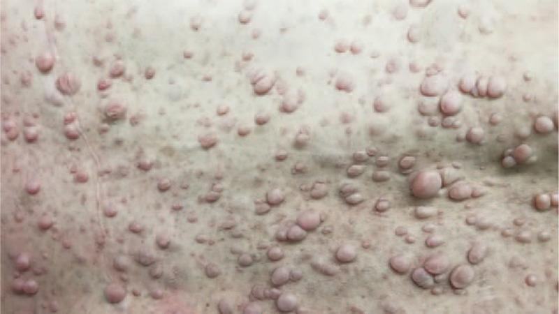 https://cdn.ncbi.nlm.nih.gov/pmc/blobs/f588/8021349/7c8dcd340810/medi-100-e25346-g001.jpg