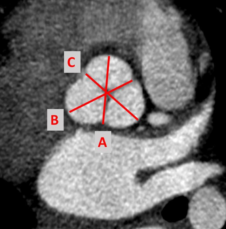 https://cdn.ncbi.nlm.nih.gov/pmc/blobs/f58c/11118707/7b929345e070/nihpp-rs4406785v1-f0002.jpg