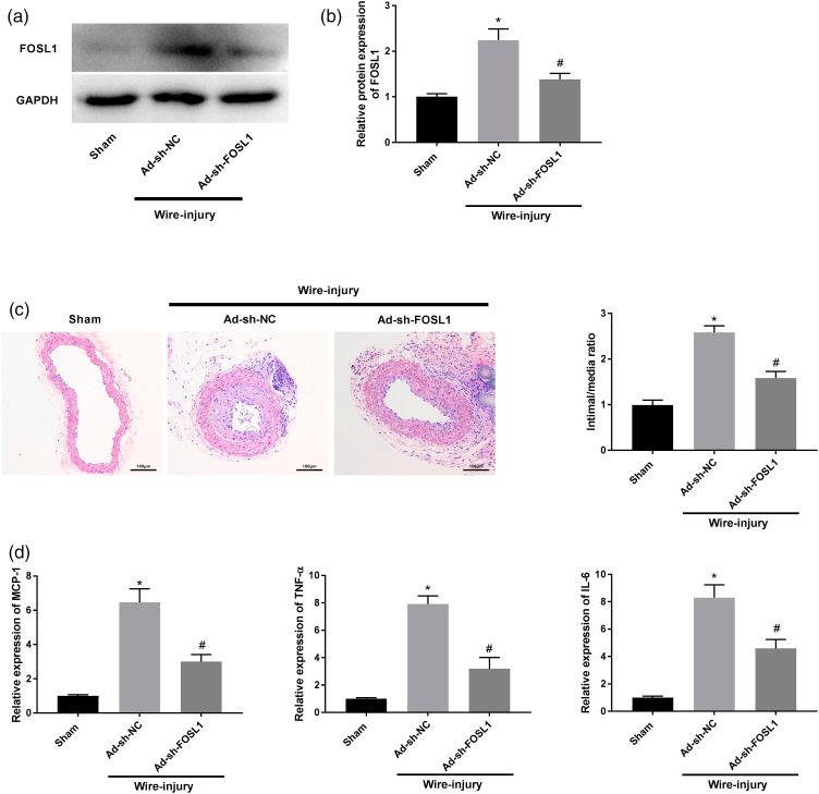 https://cdn.ncbi.nlm.nih.gov/pmc/blobs/f58c/8669130/4659f8e17d96/10.1177_14791641211058855-fig6.jpg