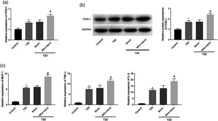 https://cdn.ncbi.nlm.nih.gov/pmc/blobs/f58c/8669130/7e587490c2da/10.1177_14791641211058855-fig1.jpg