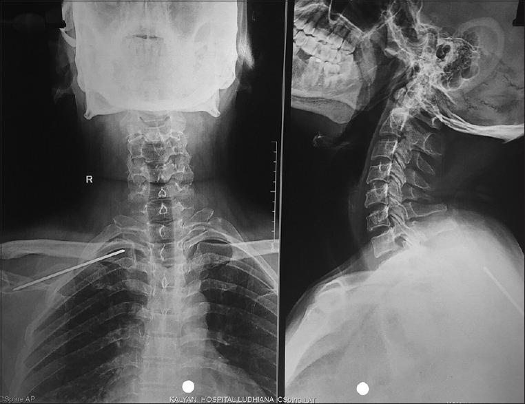https://cdn.ncbi.nlm.nih.gov/pmc/blobs/f594/6598584/b35b10e3a43d/JOACP-35-268-g001.jpg