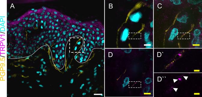 https://cdn.ncbi.nlm.nih.gov/pmc/blobs/f59c/10791129/4b299405daea/elife-77761-fig2-figsupp1.jpg