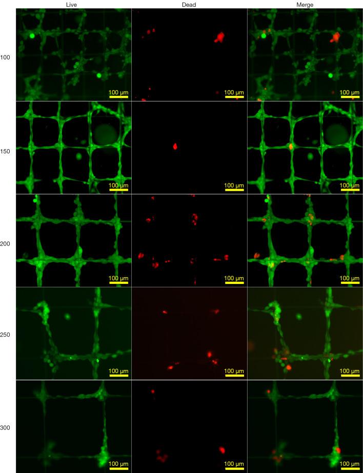 https://cdn.ncbi.nlm.nih.gov/pmc/blobs/f59e/9358502/78b6211a5b46/atm-10-13-743-f3.jpg