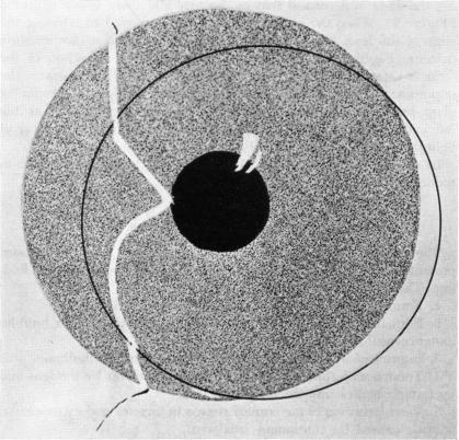 https://cdn.ncbi.nlm.nih.gov/pmc/blobs/f5a6/1316661/bdd7887b41dd/taos00038-0501-a.jpg