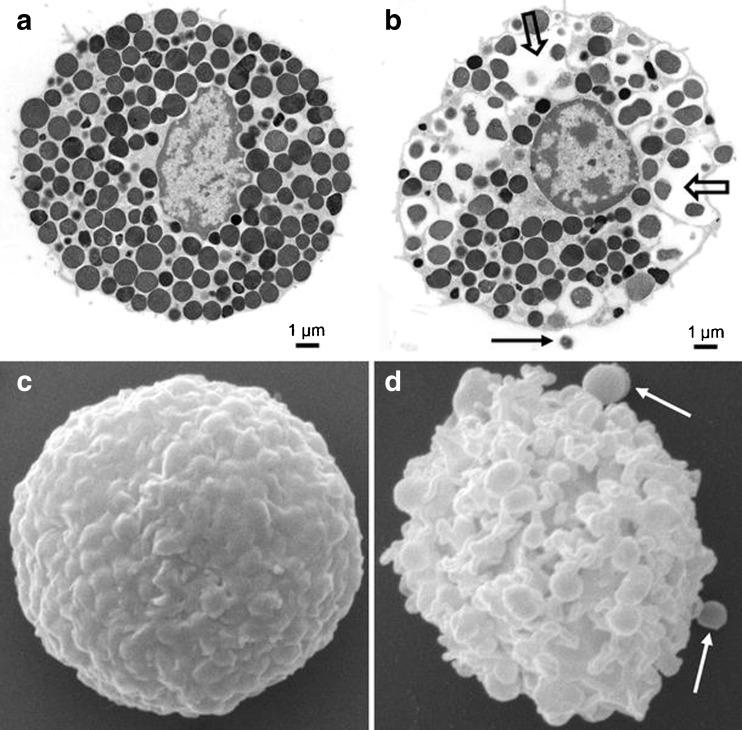 https://cdn.ncbi.nlm.nih.gov/pmc/blobs/f5b0/5487770/e795ba86cbd0/10719_2016_9749_Fig1_HTML.jpg