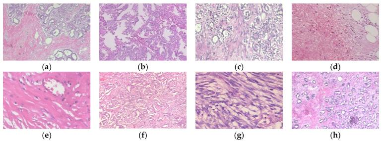 https://cdn.ncbi.nlm.nih.gov/pmc/blobs/f5b1/11475610/b6894f57c28a/diagnostics-14-02253-g001.jpg