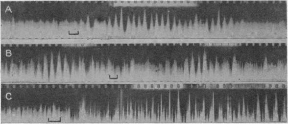 https://cdn.ncbi.nlm.nih.gov/pmc/blobs/f5b4/1393326/13be03dfa8c1/jphysiol01518-0105-a.jpg