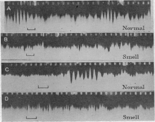 https://cdn.ncbi.nlm.nih.gov/pmc/blobs/f5b4/1393326/33ad0a3a2988/jphysiol01518-0099-a.jpg