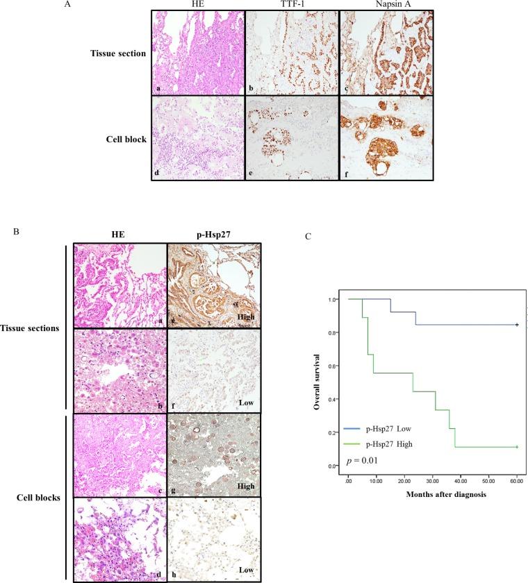 https://cdn.ncbi.nlm.nih.gov/pmc/blobs/f5b9/4924714/d207170be324/oncotarget-07-14279-g004.jpg