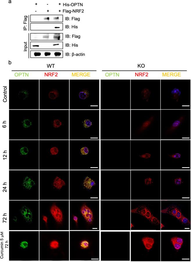 https://cdn.ncbi.nlm.nih.gov/pmc/blobs/f5bd/8102640/694d00e9d2a5/12276_2021_596_Fig5_HTML.jpg