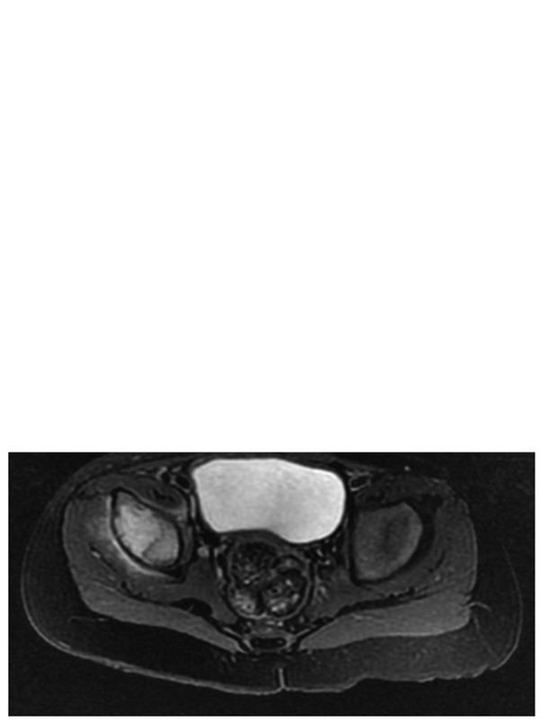 https://cdn.ncbi.nlm.nih.gov/pmc/blobs/f5cc/7086199/b9b64e1bf602/etm-19-04-2983-g02.jpg
