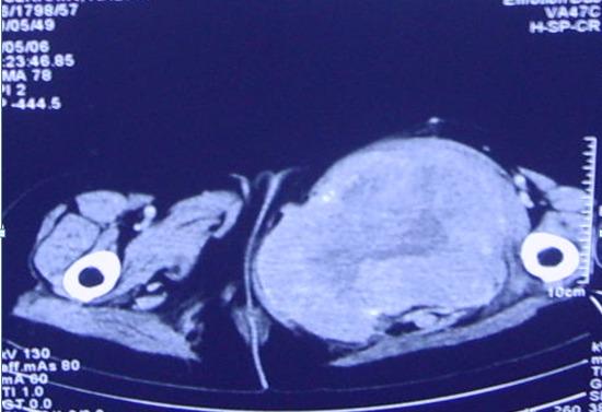 https://cdn.ncbi.nlm.nih.gov/pmc/blobs/f5d0/4214561/bcc5c192000e/PAMJ-18-23-g002.jpg
