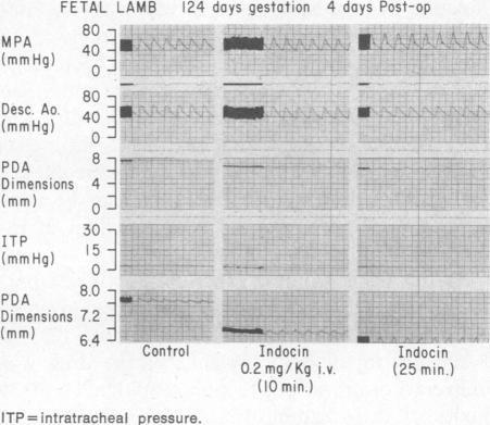 https://cdn.ncbi.nlm.nih.gov/pmc/blobs/f5d1/1238054/5eb3c343f9ae/westjmed00259-0069-a.jpg