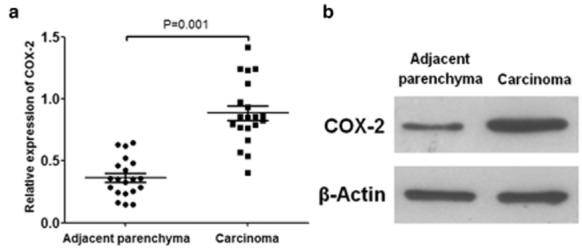 https://cdn.ncbi.nlm.nih.gov/pmc/blobs/f5d2/4632932/a85e9a67a5e0/tca0006-0778-f2.jpg
