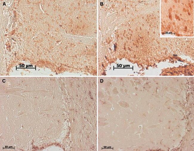 https://cdn.ncbi.nlm.nih.gov/pmc/blobs/f5d7/3282907/7f310b2d5a5d/702_2011_717_Fig5_HTML.jpg