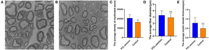 https://cdn.ncbi.nlm.nih.gov/pmc/blobs/f5de/8971199/aefdc7858ef4/fsurg-09-842540-g0008.jpg