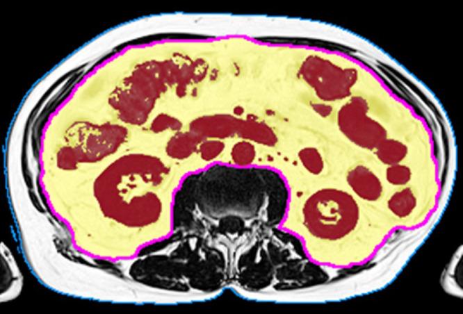 https://cdn.ncbi.nlm.nih.gov/pmc/blobs/f5e2/9869795/7dc846ff35fa/CIA-18-71-g0002.jpg
