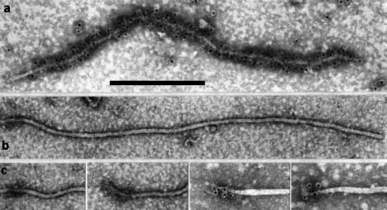 https://cdn.ncbi.nlm.nih.gov/pmc/blobs/f5e4/7414439/f784c02bb292/jgv-101-364-g001.jpg