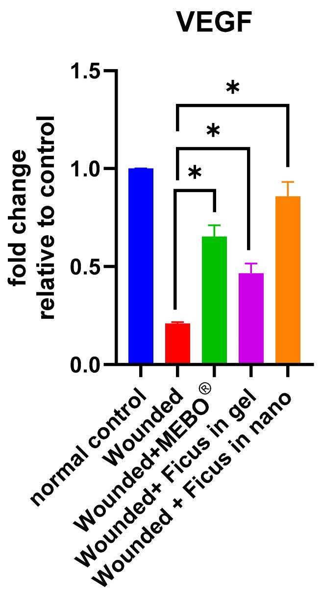 https://cdn.ncbi.nlm.nih.gov/pmc/blobs/f5e8/11817089/f9f49e009bc0/ijms-26-00928-g005.jpg