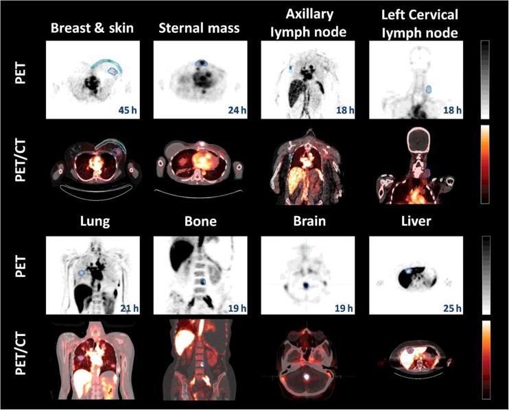 https://cdn.ncbi.nlm.nih.gov/pmc/blobs/f5ea/6153680/0abbe95e4055/11307_2018_1255_Fig3_HTML.jpg