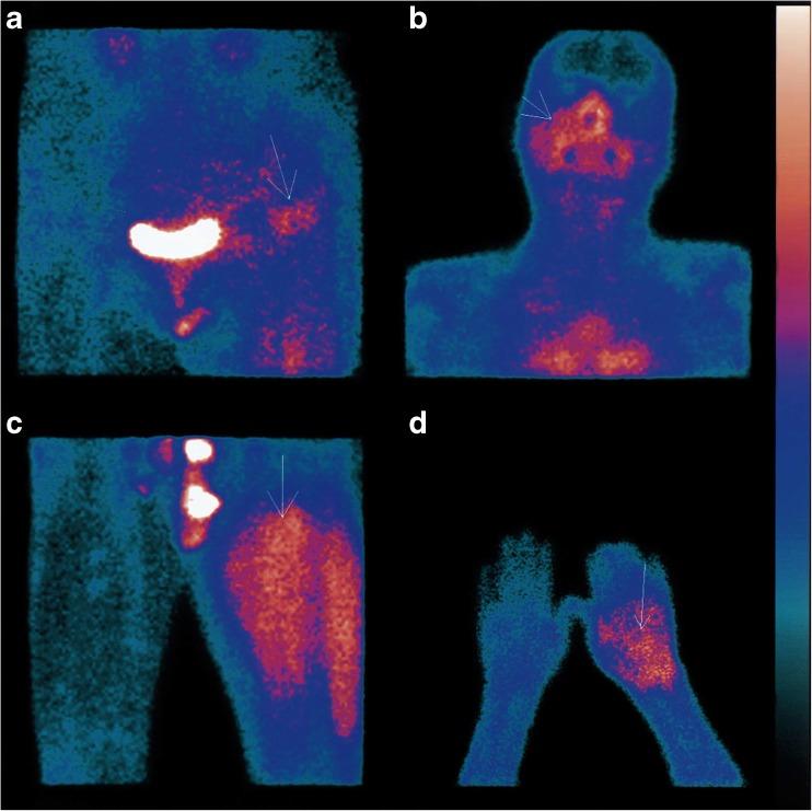 https://cdn.ncbi.nlm.nih.gov/pmc/blobs/f5ea/6153680/841be2504dfa/11307_2018_1255_Fig2_HTML.jpg