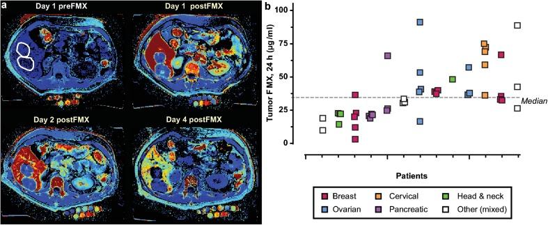 https://cdn.ncbi.nlm.nih.gov/pmc/blobs/f5ea/6153680/ceb4f4df45c9/11307_2018_1255_Fig4_HTML.jpg