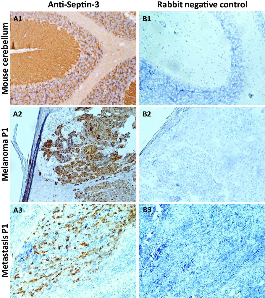 https://cdn.ncbi.nlm.nih.gov/pmc/blobs/f5f1/10061979/42b2f07739f0/12974_2023_2718_Fig5_HTML.jpg