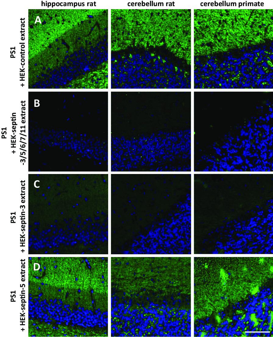 https://cdn.ncbi.nlm.nih.gov/pmc/blobs/f5f1/10061979/956bfeaeae94/12974_2023_2718_Fig4_HTML.jpg