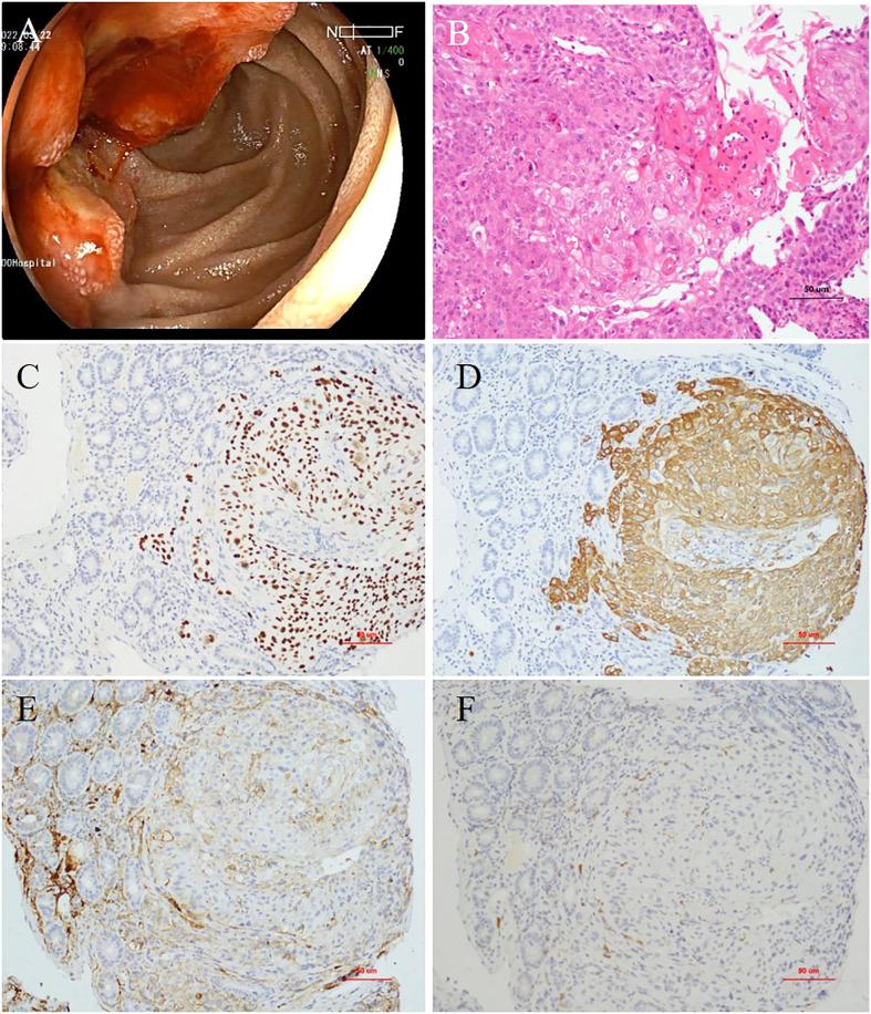 https://cdn.ncbi.nlm.nih.gov/pmc/blobs/f5f5/9911421/bee86e8cde45/fimmu-14-1086760-g001.jpg